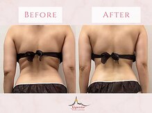 スーペリオル(Superior)