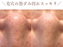 フロウ(FLOW)/毛穴黒ずみ汚れスッキリきれい