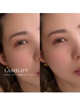 イチマルゴ ガーデン(105 GARDEN)/ラッシュリフト