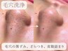 ハイドロ毛穴洗浄コース｜40分