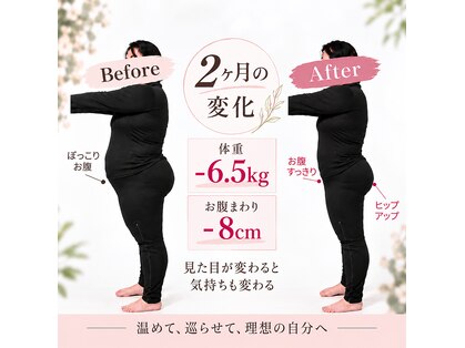 ヨサパーク ハーミスト(YOSA PARK Her Mist)の写真