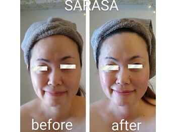 サラサ(SARASA)/ヒト幹・極上リンパリフトアップ