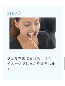 ホワイトニングショップ 桜木町店/【ステップ3】