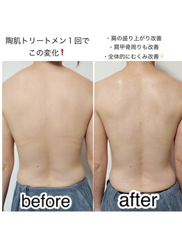 リメレ(Rimere)/【背中美人】陶肌トリートメント