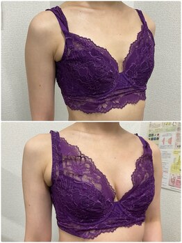 バーディー(BIRDIE)/施術3回/４０代/B→C