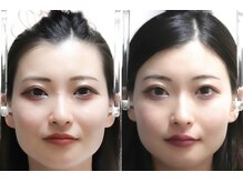 さつま骨格矯正 渋谷 恵比寿本院/葦原みゅうさん 初回効果　