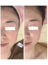 クールグラシュー(couer gracieux)/