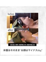 ルシエル/顎を尖らせ横顔バランスを変える