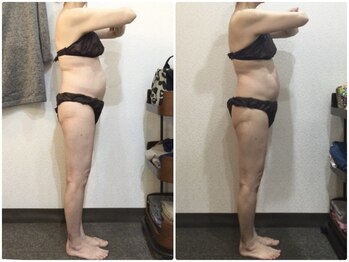 美容整体ウェリナ あま甚目寺院/小顔矯正/骨盤矯正/美脚サロン