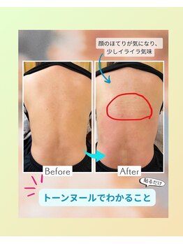 ちょこちょこの写真/肌で飲む漢方で身体の中から温め巡りを整えます。40、50代からの女性特有のお悩みにオススメ