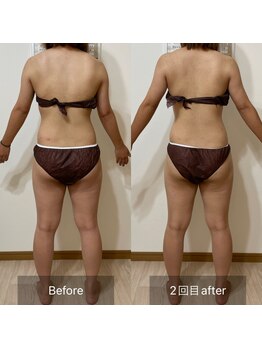 エミニー(EMINY)/