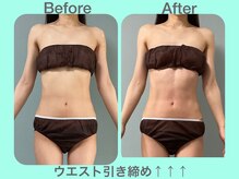 ビーナイス ビューティー(Be Nice Beauty)/★ ブライダル ★1度の変化！！