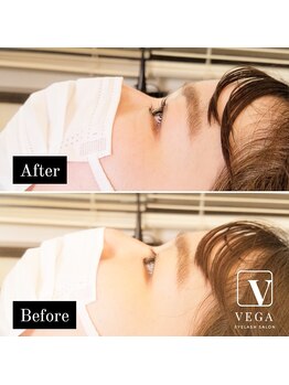 ヴィーガ(VEGA)/横顔美人の秘訣!!