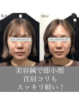 ハリサロンドオフ 心斎橋店(hari salon de off)/即小顔！