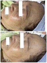 アンジェーム(angeame)/手強いおシワにもアプローチ♪