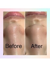 フレイヤビューティー スハダラボ 恵比寿(Freyia Beauty Suhada LABO)/-美肌へ導く-恵比寿