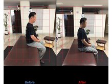 ストレチックス 近江八幡店/ストレッチ　ビフォーアフター