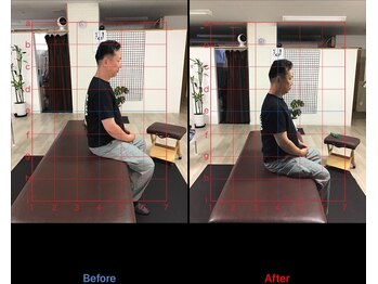 ストレチックス 近江八幡店/ストレッチ ビフォーアフター