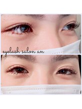 アン(an)/★LEDマツエク100本★