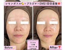 エスポワール(Espoir)/レモンボトル導入しました！