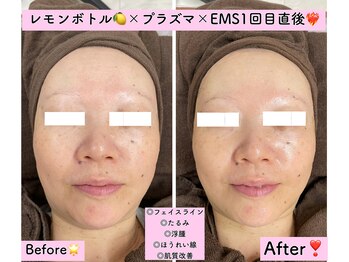 エスポワール(Espoir)/レモンボトル導入しました!