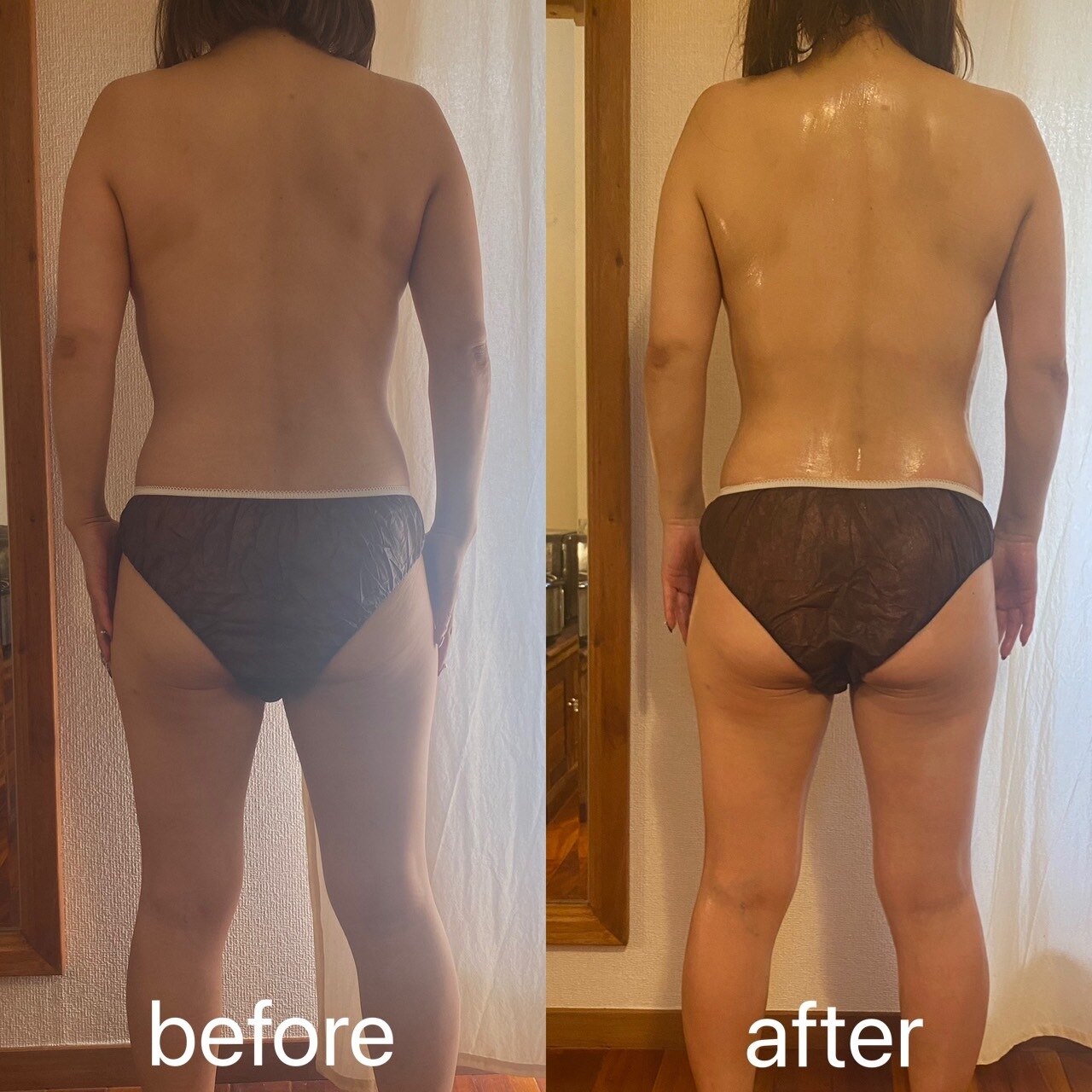 ソルトと発汗シートを組み合わせた施術