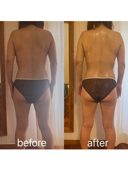 リュミエール デスポワール(lumiere d'espoir)/爆汗・肩こり&むくみリンパ