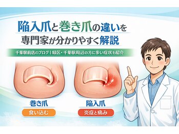 巻き爪じゅん 千葉駅前店/陥入爪と巻き爪の違い院長が解説