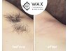 【匠道WAX】まとめてワックス脱毛◆腕全体 脇WAX脱毛　通常12800円