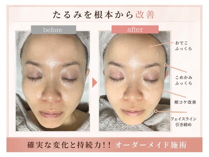 グロウ バイ フェイシャルデザイン アンド アイ(GROW)の写真