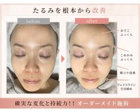 グロウ バイ フェイシャルデザイン アンド アイ(GROW)