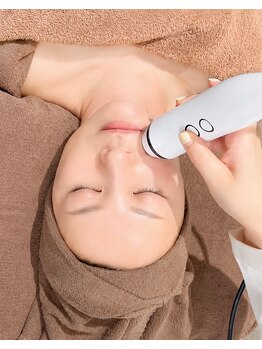 トラット エステアンドアイズ(tratto)の写真/【プラズマフラクショナル】頬と鼻の開き毛穴やたるみ毛穴サヨナラ！回数を重ねる度に凹凸が改善！！