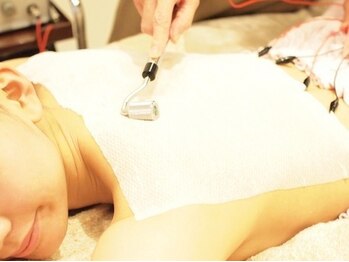 ア リトルエステ フェリス/背中のニキビやくすみ肌荒れに