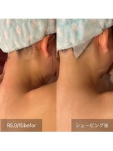 サンベリーナ(Thumbelina)/シンデレラケア