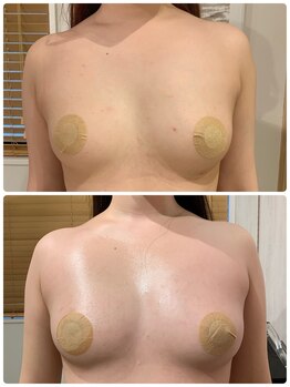 ルナグランデ(Luna grande.)/ボリューム&左右のお胸を均等に