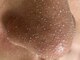 エルフ(elf)の写真/【韓国式3D毛穴洗浄取り扱い店】◎”美顔を目指すならまず毛穴から！”全体の毛穴を引き締め根本改善へ！