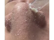 ベル(BELL)/汚れごっそり！感動の毛穴洗浄！