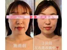 ウルワシ(Uruwashi)の雰囲気（　オールハンド左右差改善！before afterはフォト、ブログにも！）