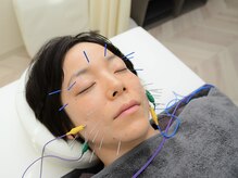 ココ(Coco)/美容鍼の施術