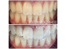 ホワイトニングルーム 横浜店(Whitening Room)/セルフホワイトニング/横浜