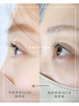 シュエット(chouette)/before/after