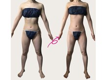 ネオボディ(Neo Body)の雰囲気(初回から効果を実感♪リバウンドもしにくい理想的な身体に◎)