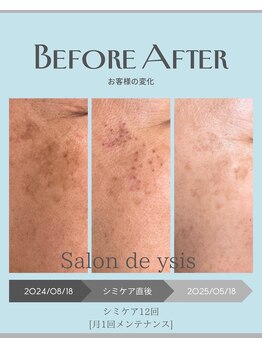 サロン ド ワイシス(Salon de ysis)の写真/気になるシミにアプローチ。自信が持てる素肌へ