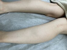 ナノハナ/鹿沼市の全身脱毛美容室ナノハナ