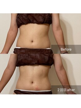 エミニー(EMINY)/