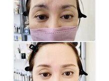 ベールス(Bellus)/アイブロウスタイリング