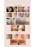 【特許取得!美療脱毛◎黒ずみ・臭い・ハリ同時改善◎】大人のVIO脱毛￥11,000