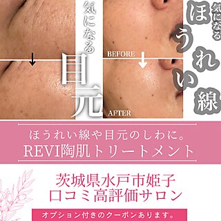 ja　陶肌 ビハニエル｜ホットペッパービューティー