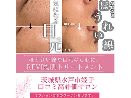 ヴィヴフォー(VIV for)の写真