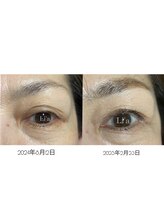 トータルビューティーサロンリア(Li'a)/【40代後半のお客様】